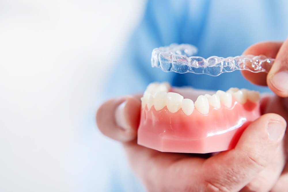 invisalign before and after