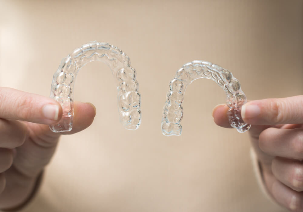perlukah retainer setelah invisalign