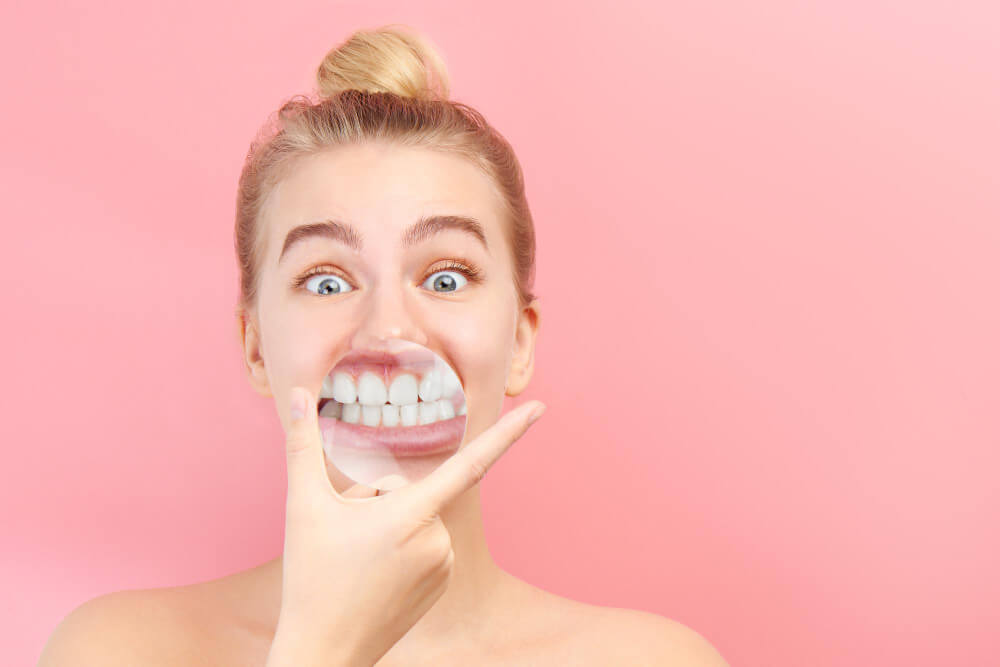 waktu pemakaian invisalign