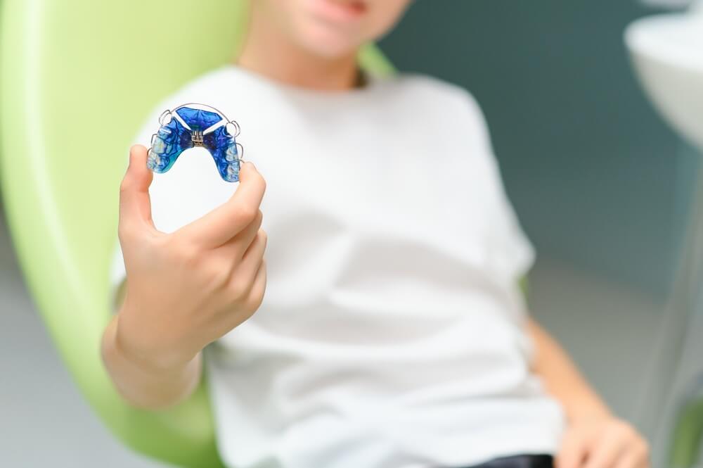 invisalign-palatal-expander-dan-palatal-expander-konvensional