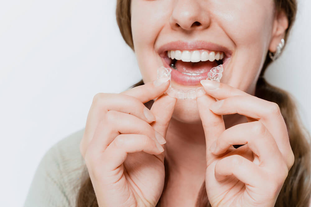 invisalign-untuk-kasus-gigi-dari-ringan-hingga-kompleks
