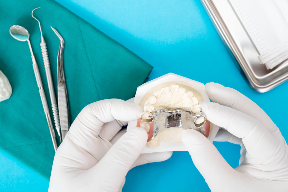 biaya-palatal-expander-invisalign